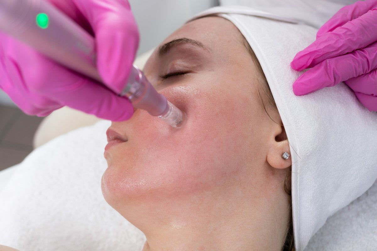 ghk-cu microneedling