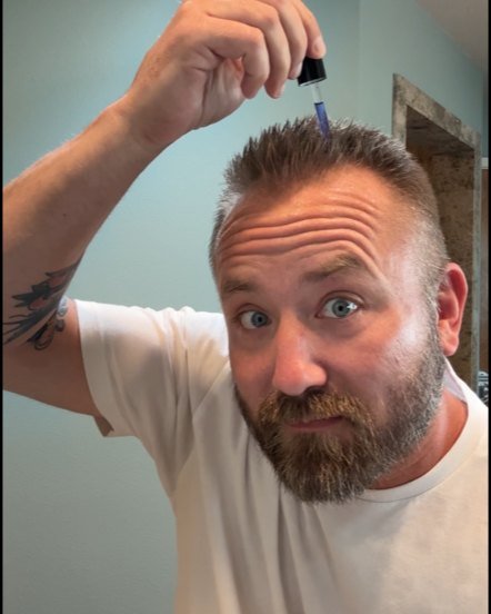 A customer applying the GHK-Cu Hair Tonic at his hairline